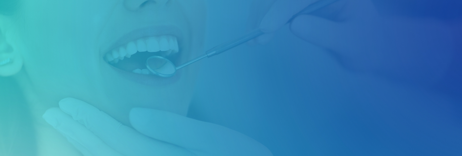 Blanqueamiento dental en Boadilla del Monte